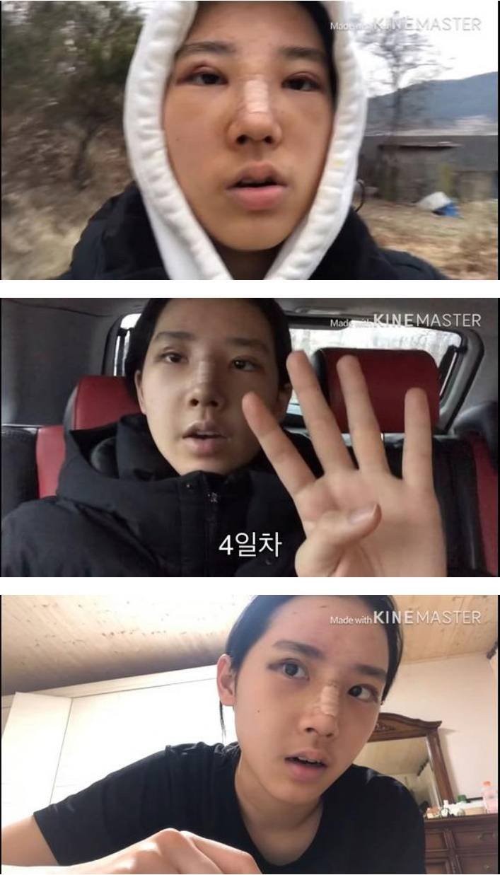 본문 이미지